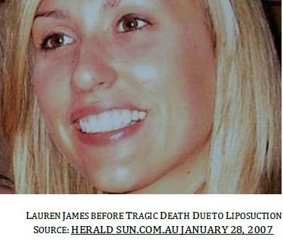 liposuction tragedy